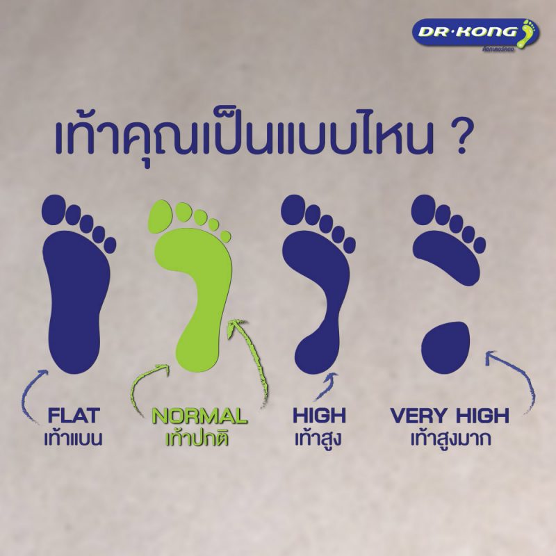 รองเท้าเพื่อสุขภาพ Dr.Kong สำหรับผู้ที่รักสุขภาพ หรือผู้ที่มีปัญหาเท้าแบน ปวดขา ปวดเข่า เพื่อสุขภาพเท้าที่ดีกว่า
